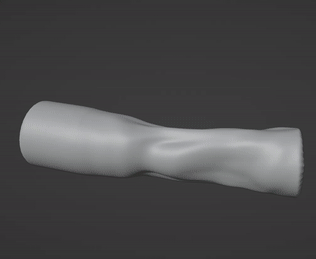Gross Deformations